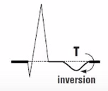 T-inversion