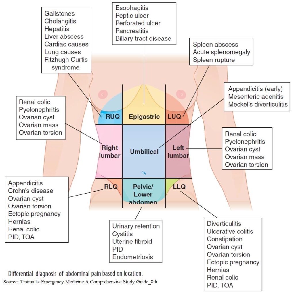 Akut Abdomen Medicin wiki